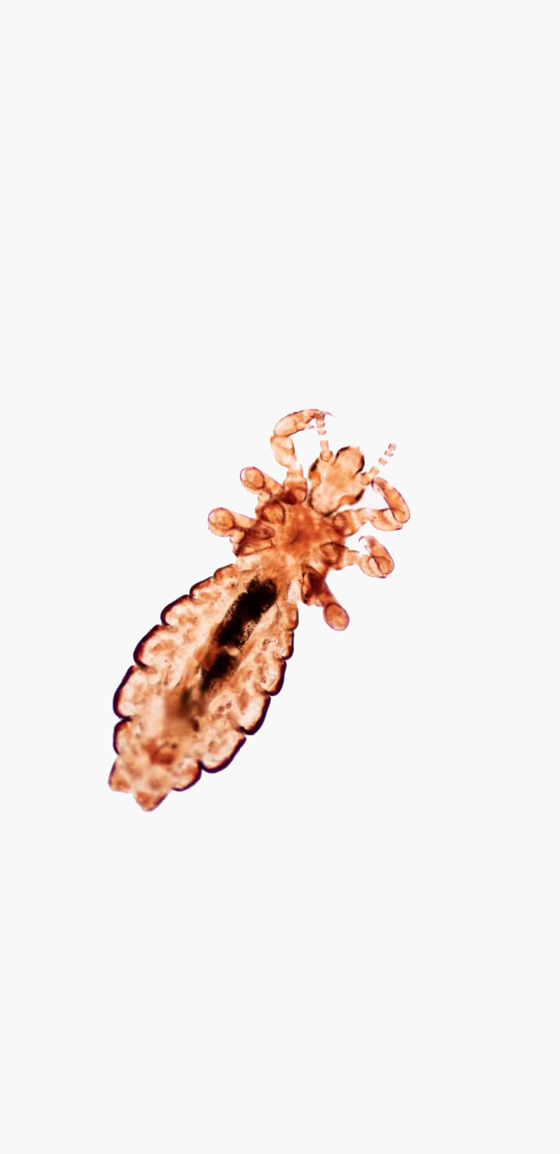 bird-lice-bottom-img-2 copy bird-lice-bottom-img-2 copy